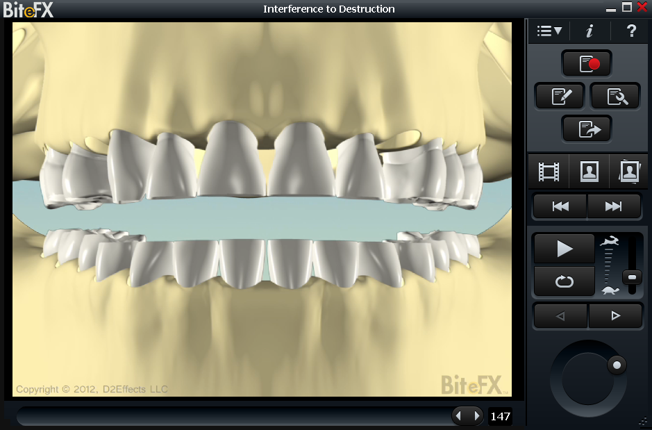Dental case presentation showing total destruction from untreated dentition