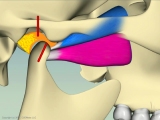 upper and lower pterygoid