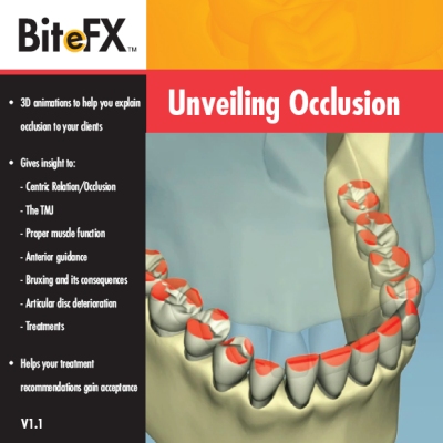 BiteFX V1.1 Upgrade from V1.0