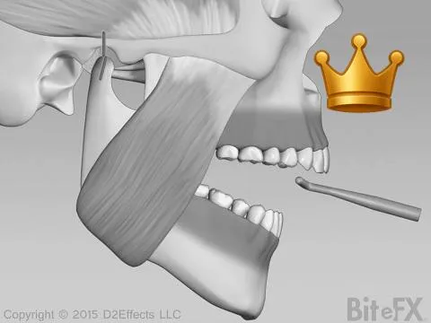 Additive Equilibration