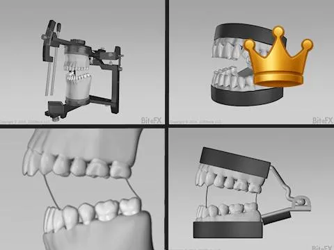 Articulator Comparison