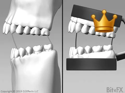 Articulator Iss. (Denar)