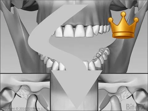 Asymmetric Open-Close