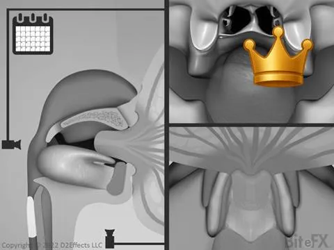 Unhealthy Palate Dev.