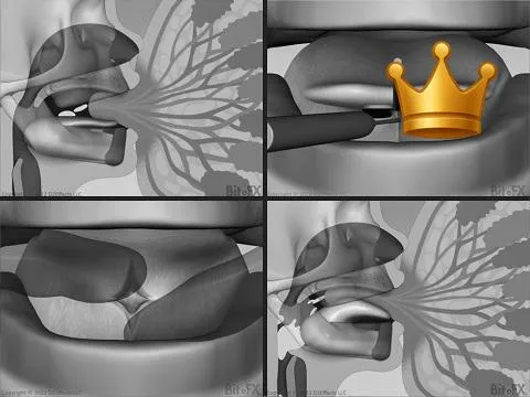 Baby TT Thru Release