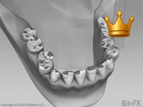 Destructive Contacts