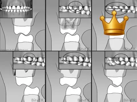 Comp. of All Effects