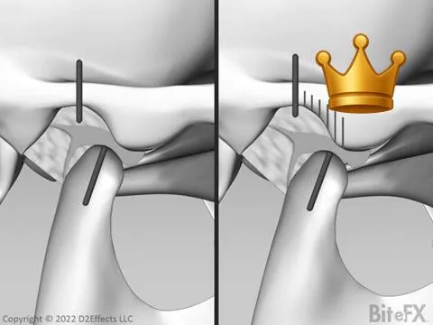 Positioning Mscls Comp