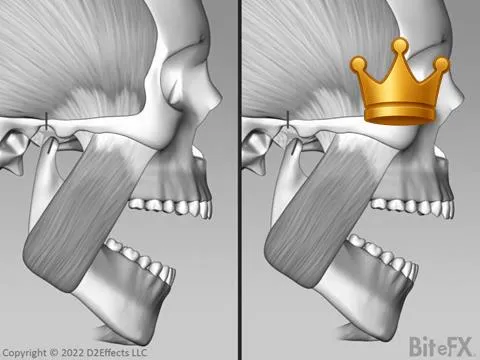 Open Close Comparison