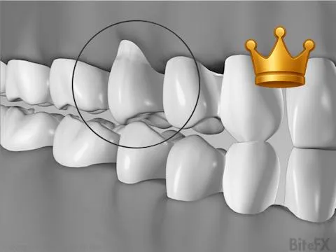 No Canine Guide+Gums