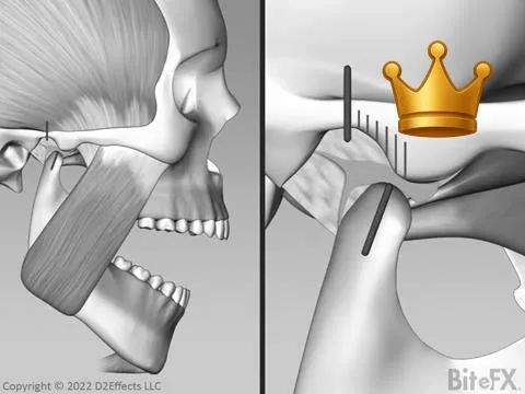 Dest: O-C All Muscles