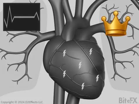 Plaque -> Heart Attack