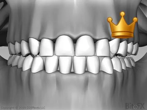 Balancing Interference