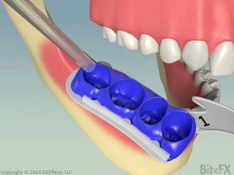Bridge + Impressions