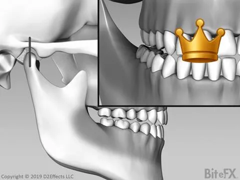 Canine Guide Crossover