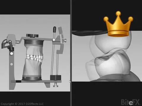 Bite Record Comparison