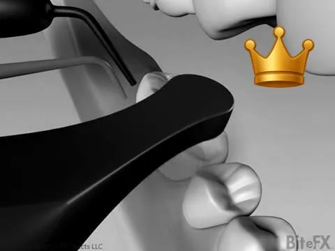 Comp. Fill. Full Process