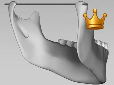 Condyle 360 Rotation