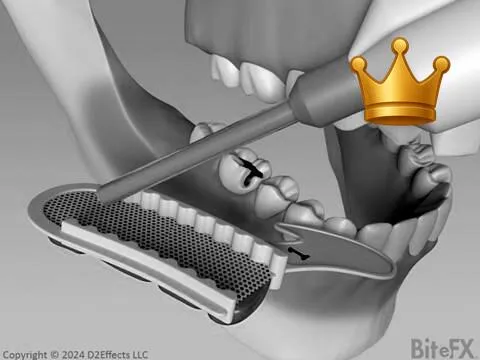 Crown With Impressions