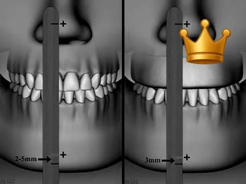 IR Space + Determining