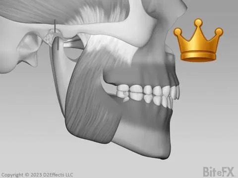 Disappearing Crown Space
