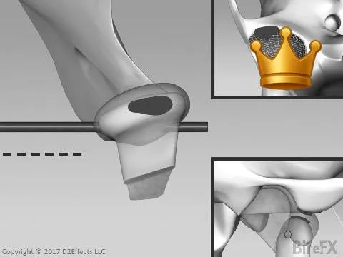 Disc Healthy Pressure P.