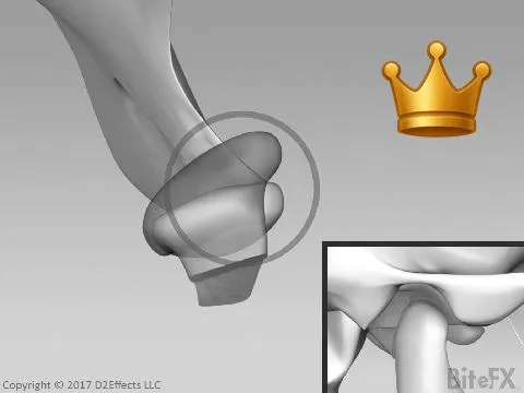 Slip Recap Pressure P.