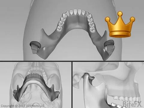 Slip Recap Multi-View
