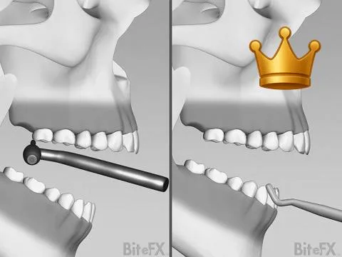 Reduct+Add Equilibration