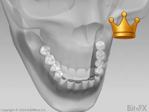 Repos. Teeth + Equil.