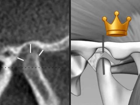 5CP: Centered and Down