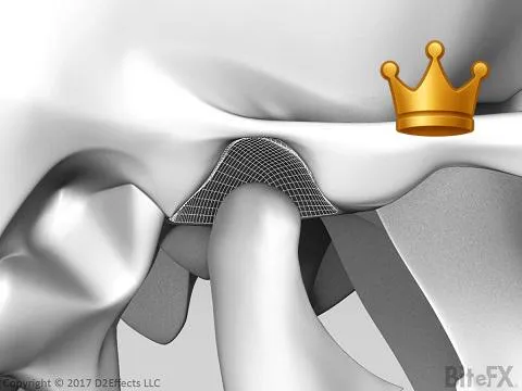 Fossa Cond. Rotation