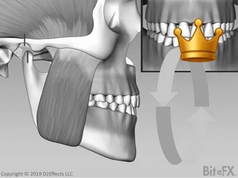 Fremitus RestrictedEnv