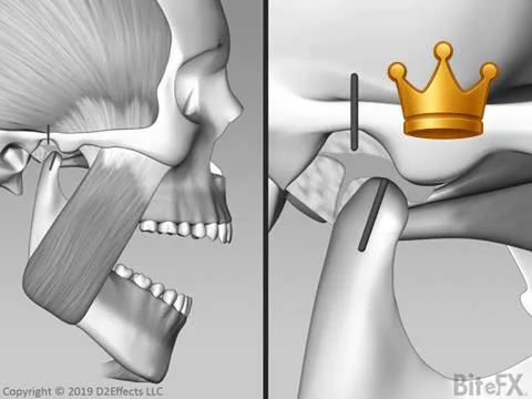 Open Close Split View