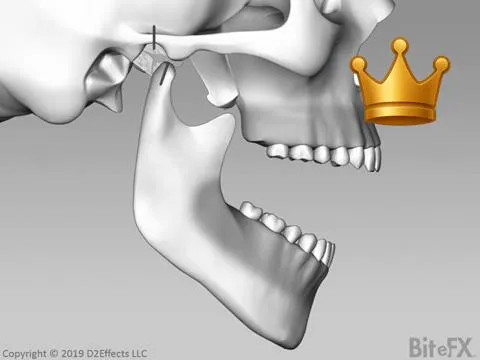 Open Close No Muscles