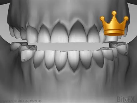 Interference Destruction V2