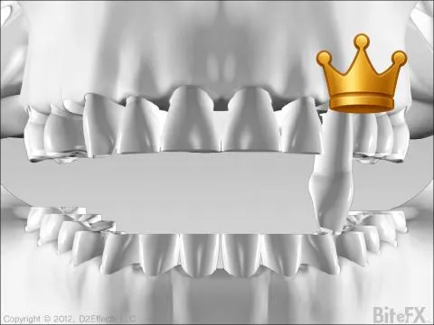 Interference Destruction V1