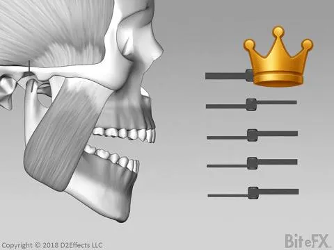 Leaf Gauge - Detailed