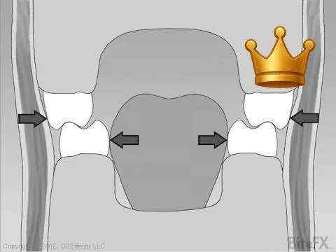 Neutral Zone - Front