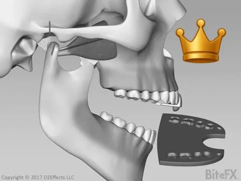 Bite Record: Out of CR