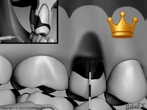 Perio + Bad Bite Switch