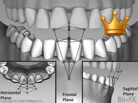 Posselt's Envelope 3D