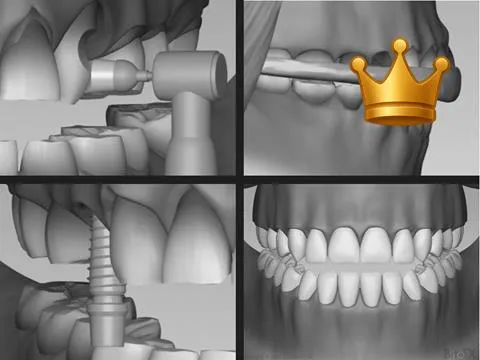 Rebuild Full Health V2