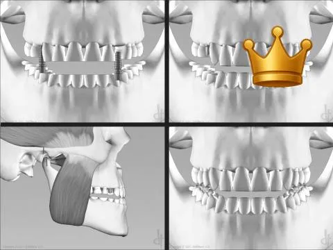 Rebuild Full Health V1