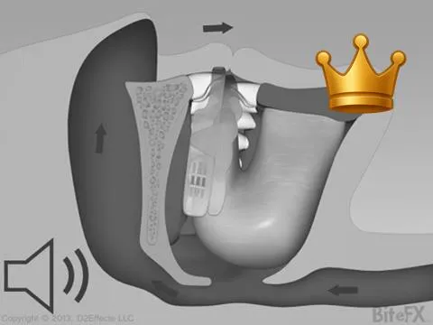 Sleep Apnea +LipSeal