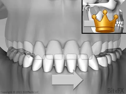 Slide with Lateral Move