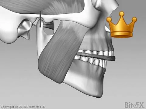 Flat Plane - Asymptmtc