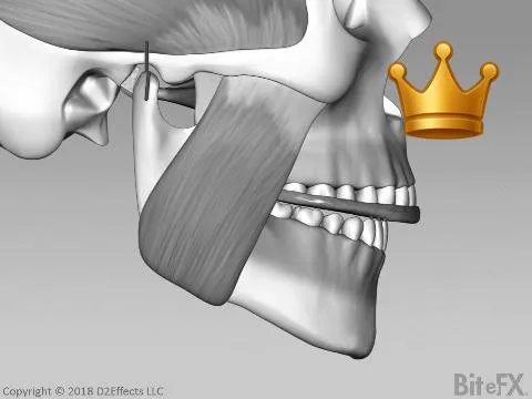 Flat Plane - Symptmtc