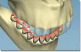 BiteFX allows the patient to quickly understand the effects of destructive tooth contacts with animation