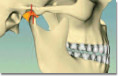 Animation helped explain anterior guidance and why lack of guidance contributed to wearing of teeth